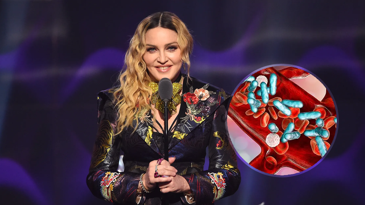 Madonna Opens Up About Her Battle With Sepsis: What You Need to Know About the Causes, Symptoms, and Treatment