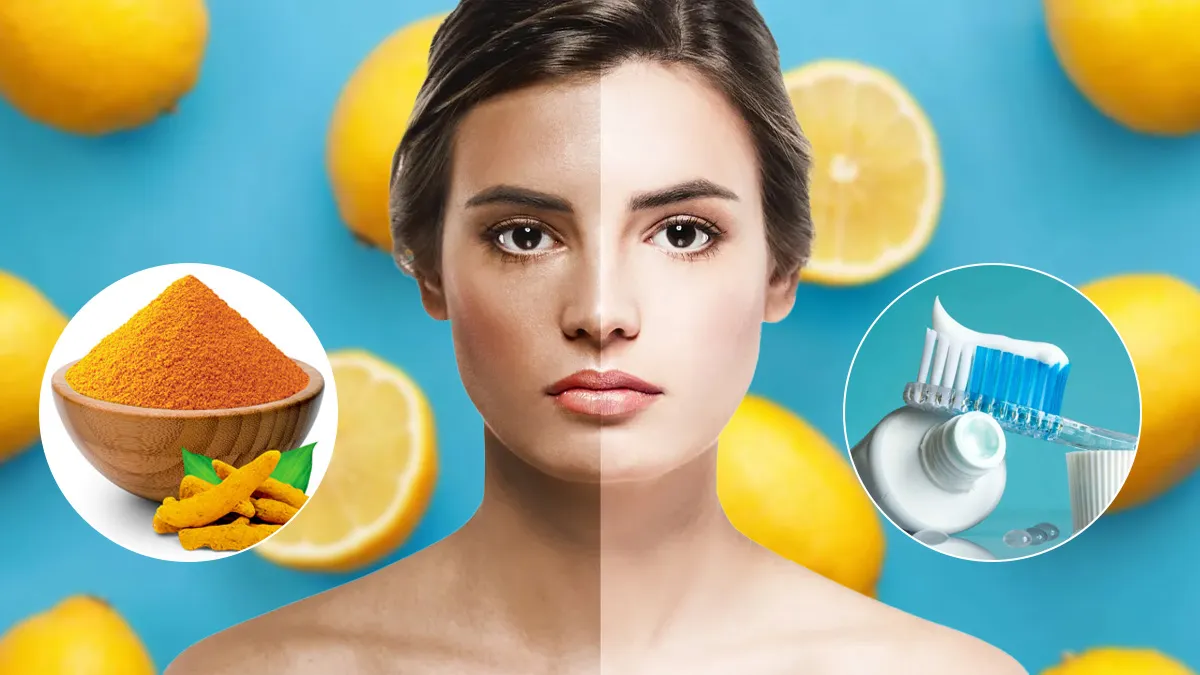 Can Lemon, Toothpaste, and Turmeric Really Remove Tan? Experts Reveal the Truth
