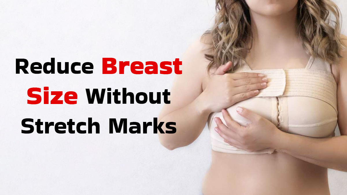 How to Reduce Breast Size Without Stretch Marks? Expert Shares Tips That Actually Work