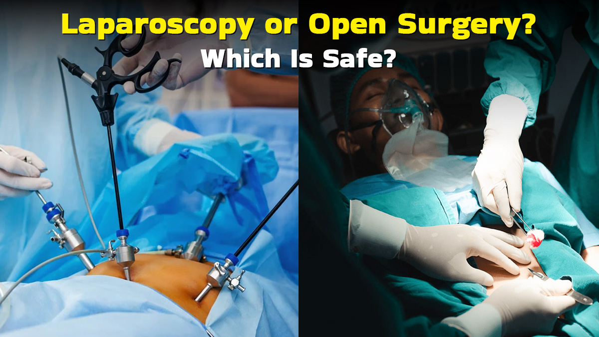Laparoscopy vs Open Surgery: Which Is Safer and Less Painful?