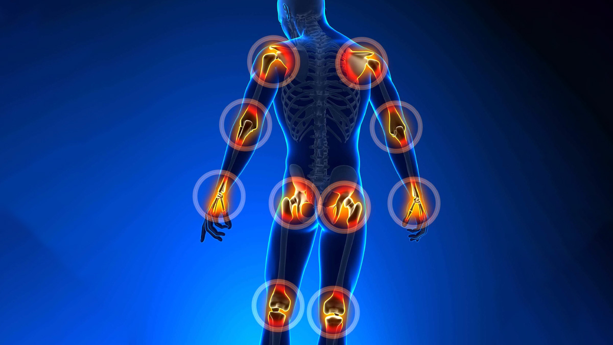 Joint Pain in Your 20s and 30s? It Could Be Early Inflammatory Arthritis