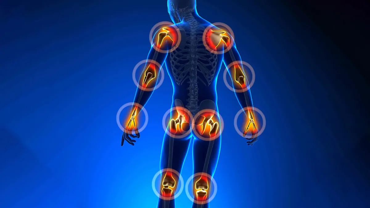 Joint Pain in Your 20s and 30s? It Could Be Early Inflammatory Arthritis