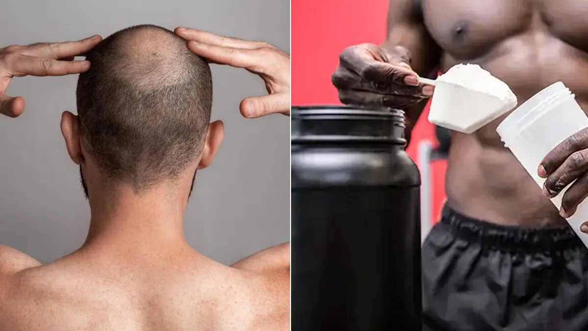 Does Creatine Cause Hair Loss? Dermatologist Answers Common Concerns