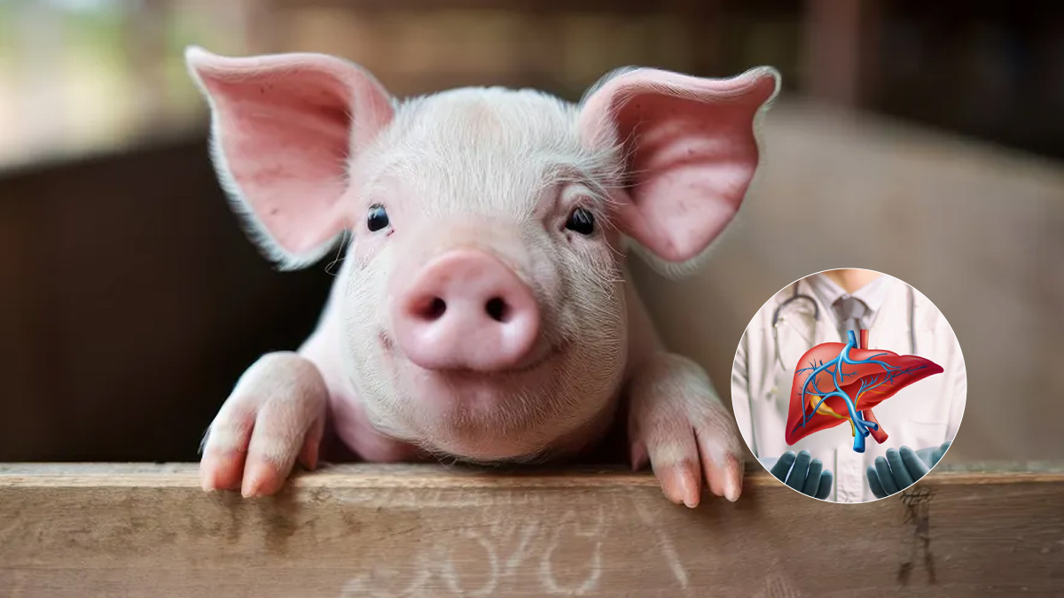 For Over 170 Days, Chinese Man Was Alive Through A Pig Liver Transplant - Report