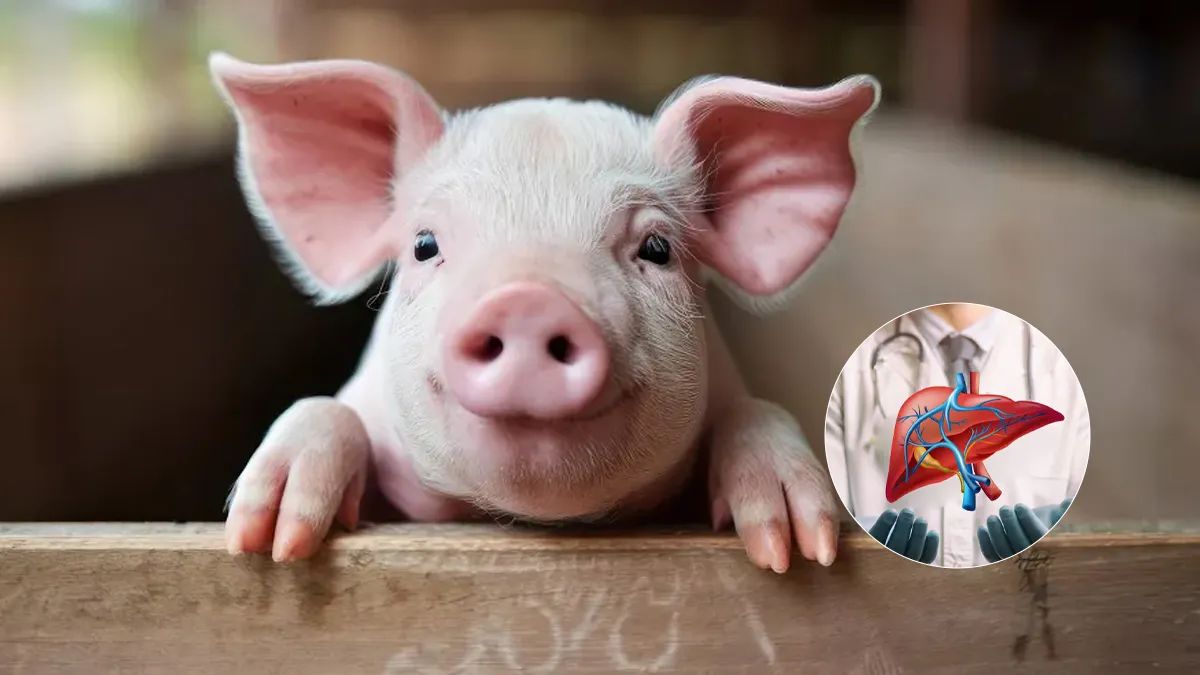 For Over 170 Days, Chinese Man Was Alive Through A Pig Liver Transplant - Report