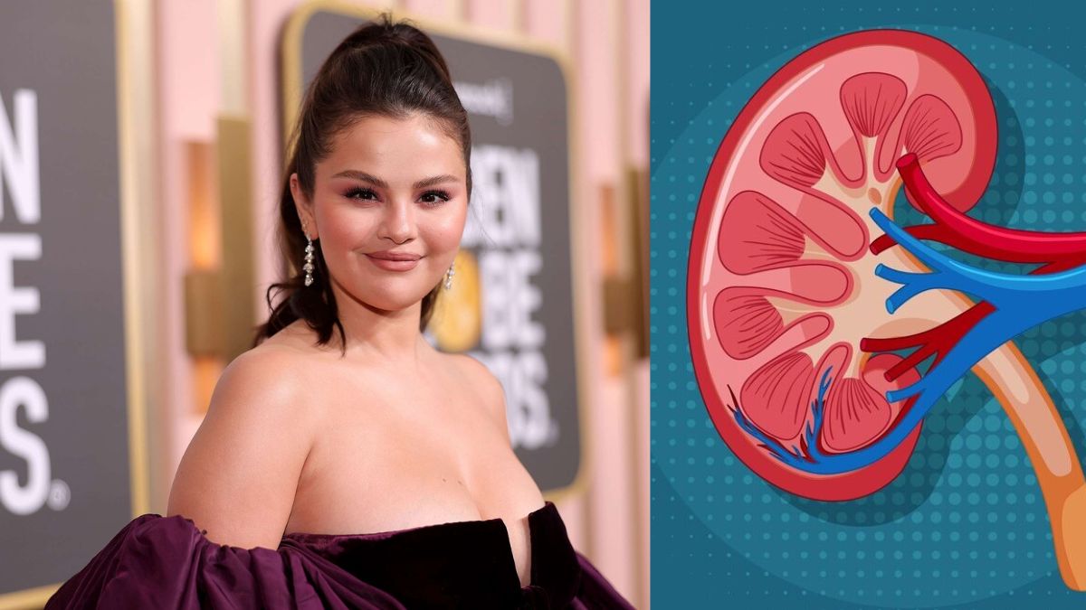 Why Selena Gomez Needed a Kidney Transplant: Understanding Lupus Nephritis