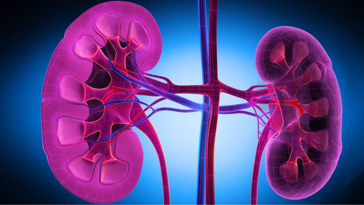 lupus mephritis _Lupus Nephritis