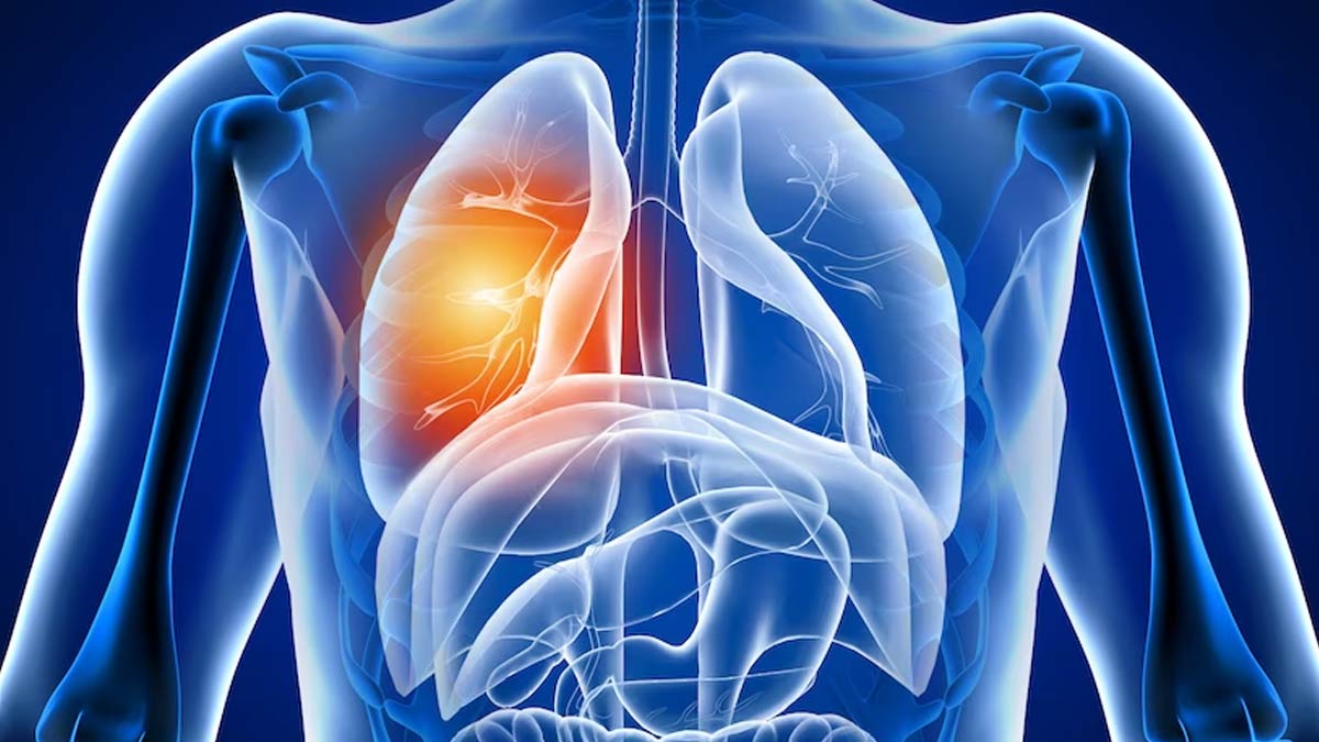 Beyond the Cough: Expert Shares 7 Subtle Signs of Lung Disease