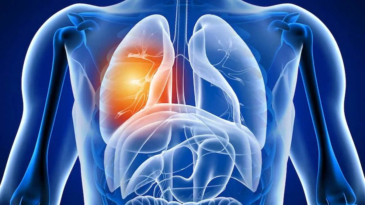 Beyond the Cough: Expert Shares 7 Subtle Signs of Lung Disease