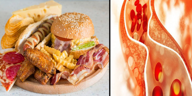 cholesterol-control-1