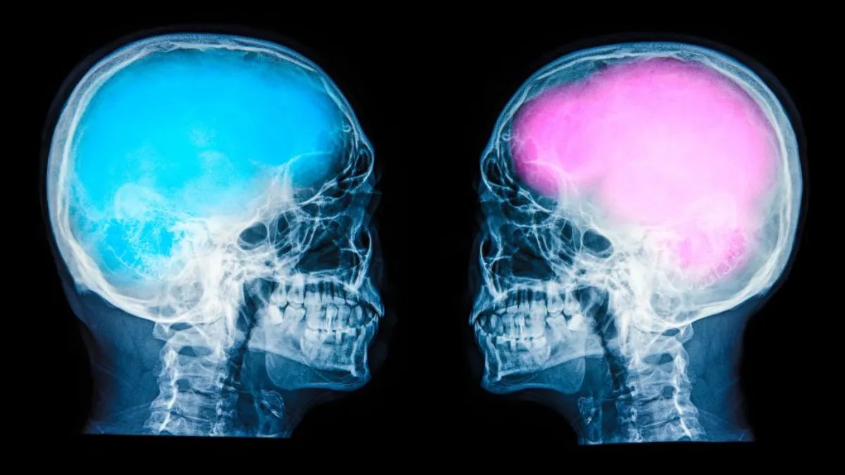 Men’s Brains May Age More Rapidly Than Women's, Claims New Study