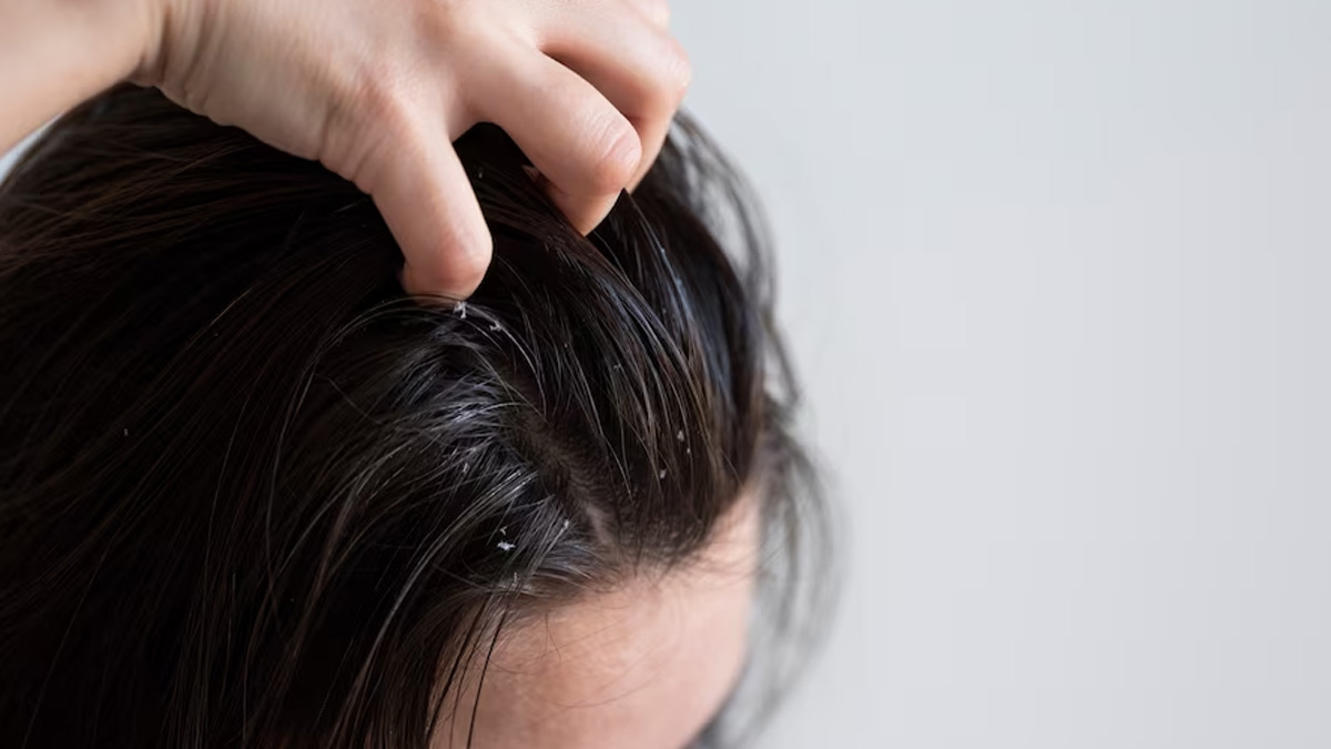 oily-hair