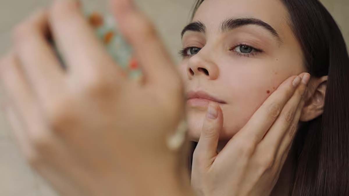 2-pores