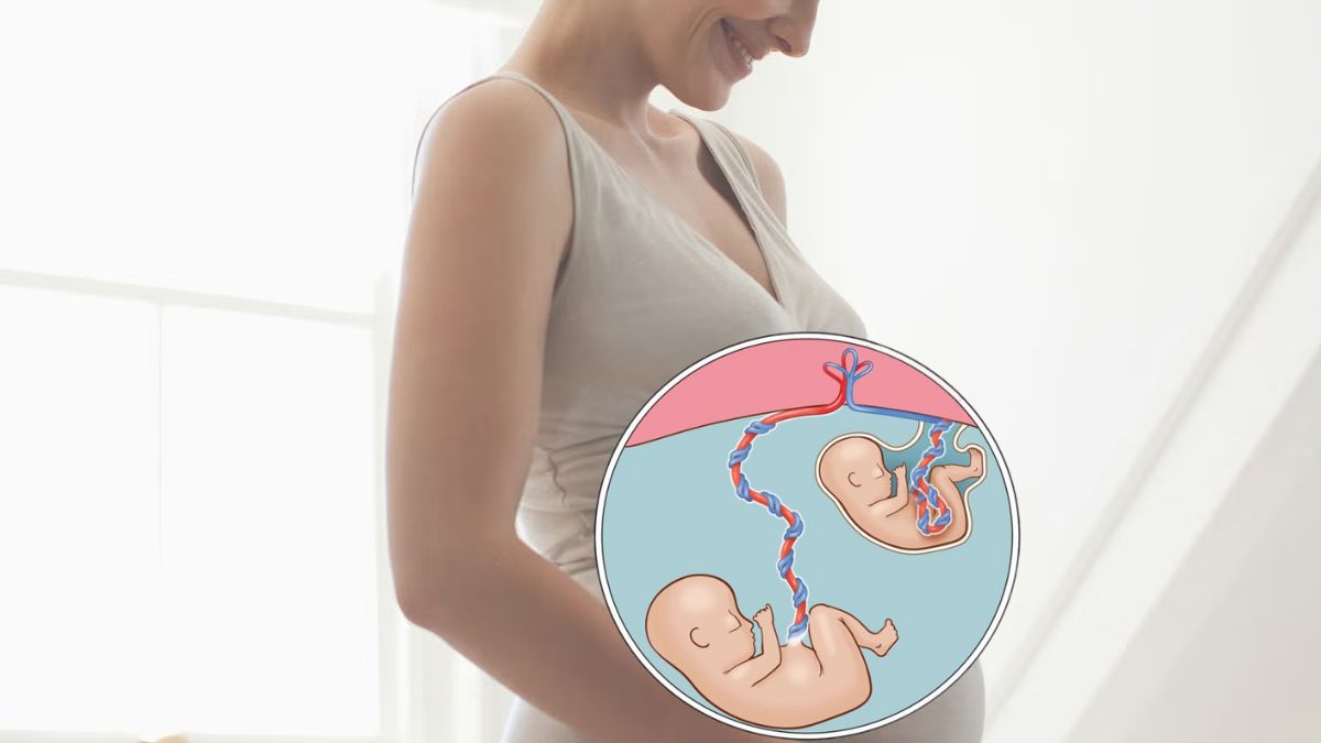 Can You Naturally Boost Your Chances of Having Twins? Gynecologist Explains