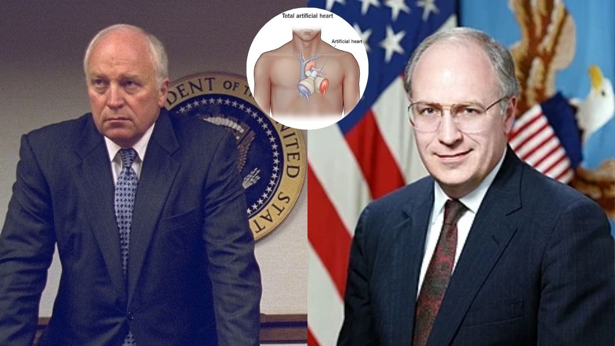 Dick Cheney, Former US Vice President Who Lived With a Mechanical Heart Dies At 84