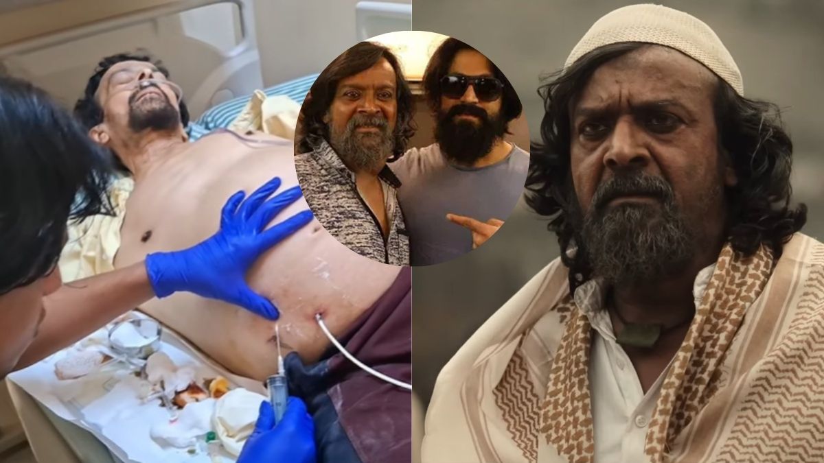 Harish Rai, Known For KGF’s ‘Khan Chacha’ Died Due To Thyroid Cancer - Report