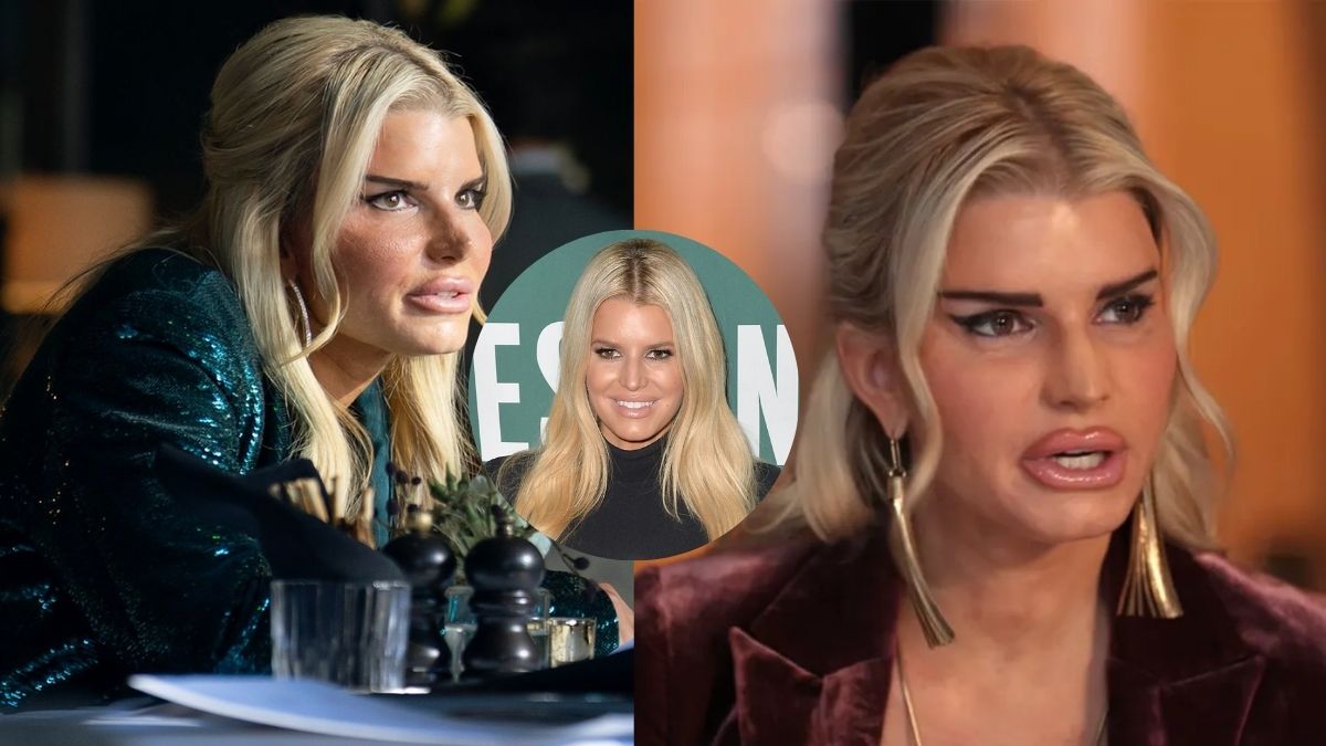 Jessica Simpson’s Botched Plastic Surgery: Expert Explains What Really Goes Wrong
