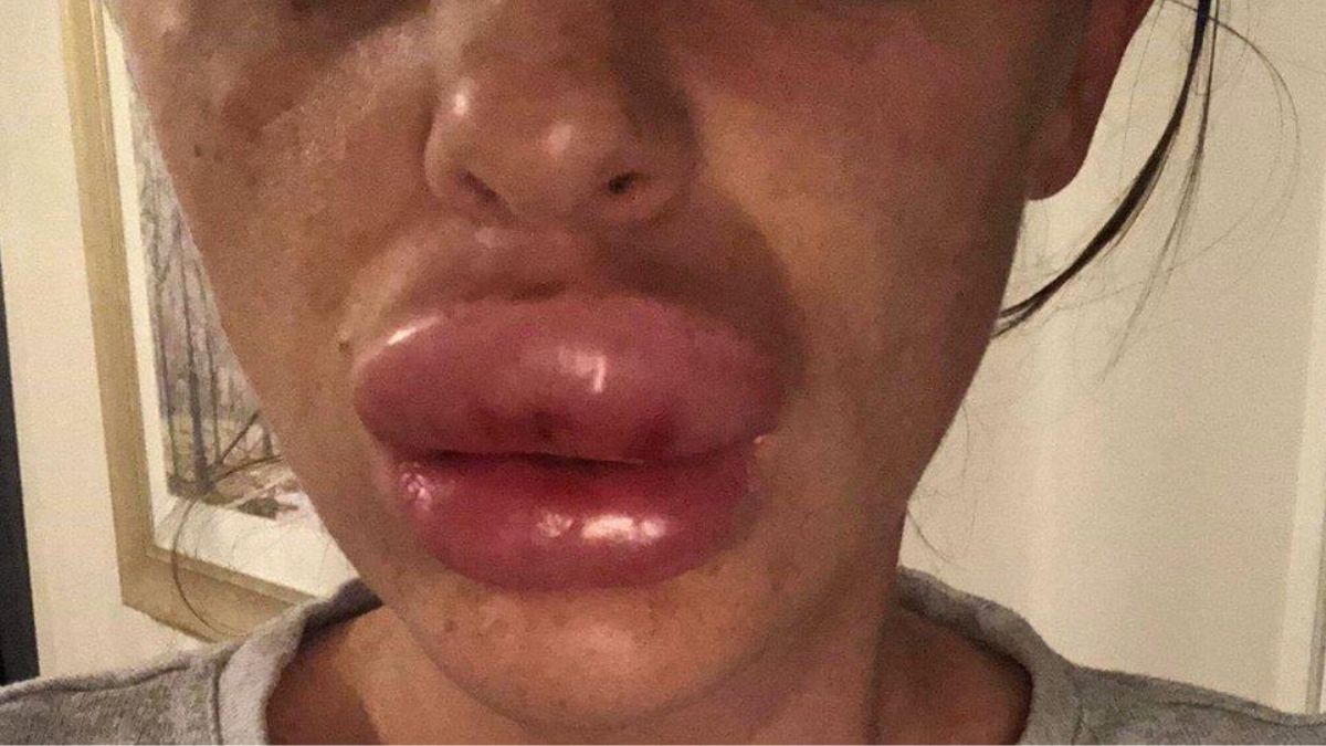 botched plastic surgery botched plastic surgery