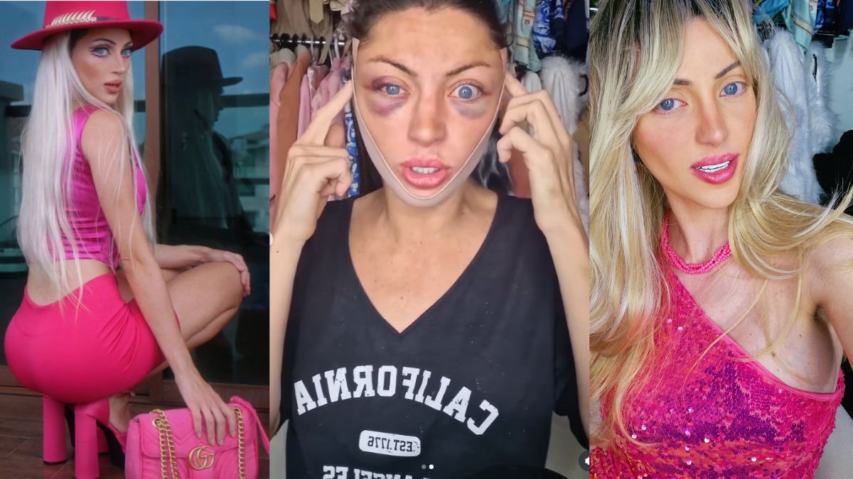 With 27 Plastic Surgeries, ‘Human Barbie’ Barbara Jankavsk Dies at 31 - Report