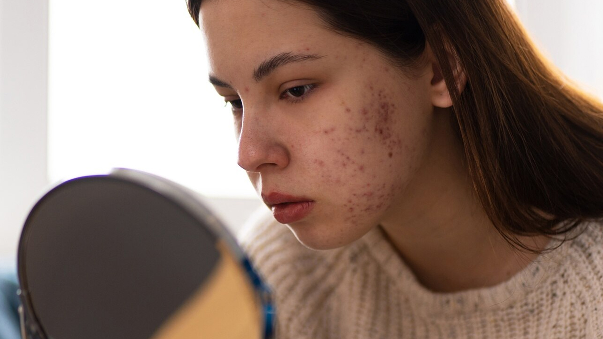 ‘Teens’ Skin Not For Elaborate Viral Skin Care Routines’ Dermatologist Warns Long-Term Health Issues Including Cancers