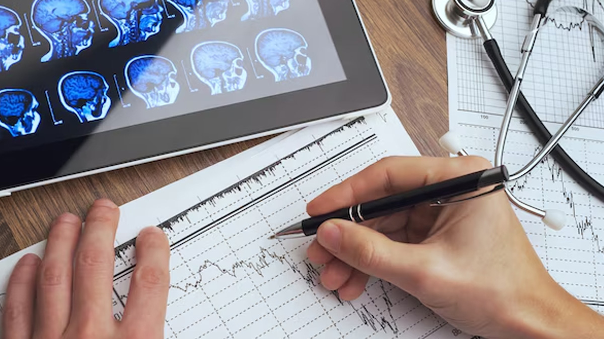 AI In Stroke Diagnosis