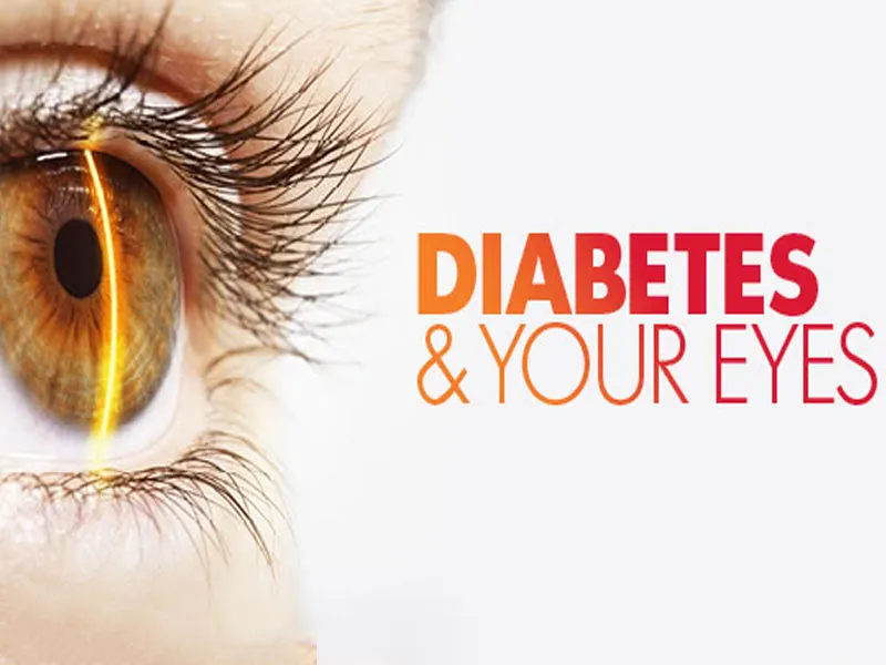 Diabetes and Eye Health: Expert Shares Hidden Infections and Conditions That Can Arise
