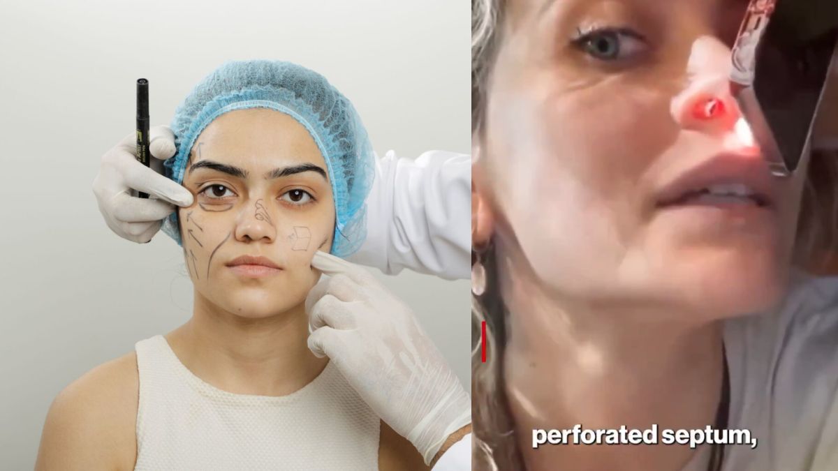 perforated septum perforated septum