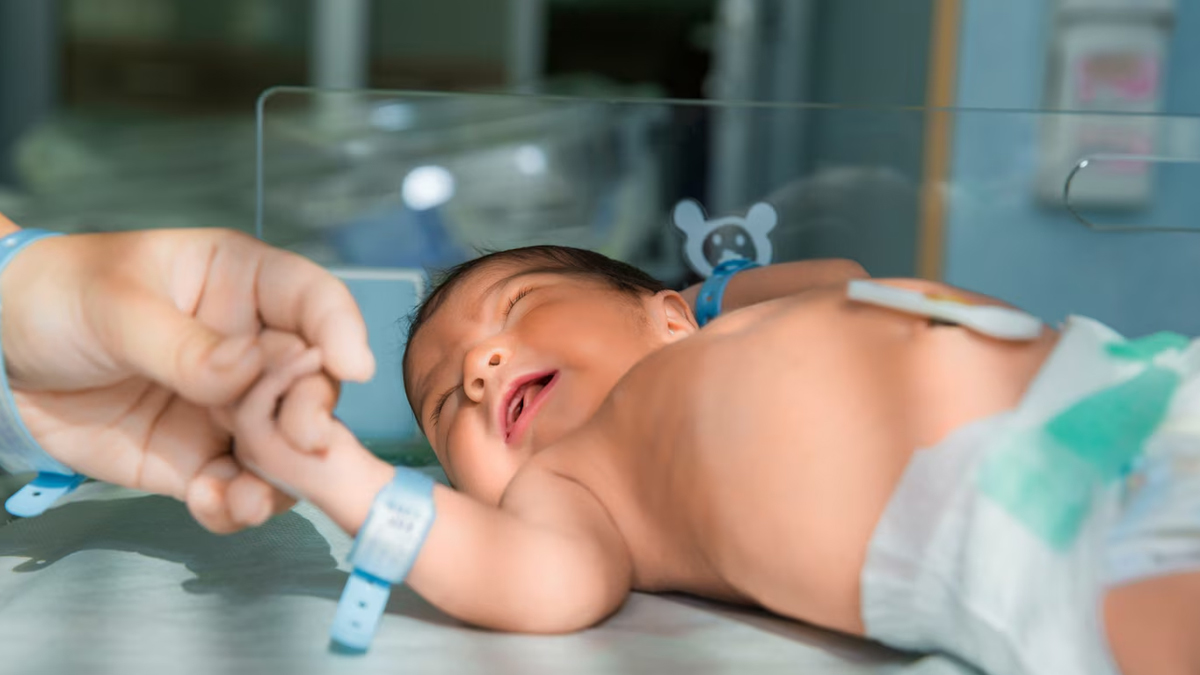 Breastfeeding preterm Babies