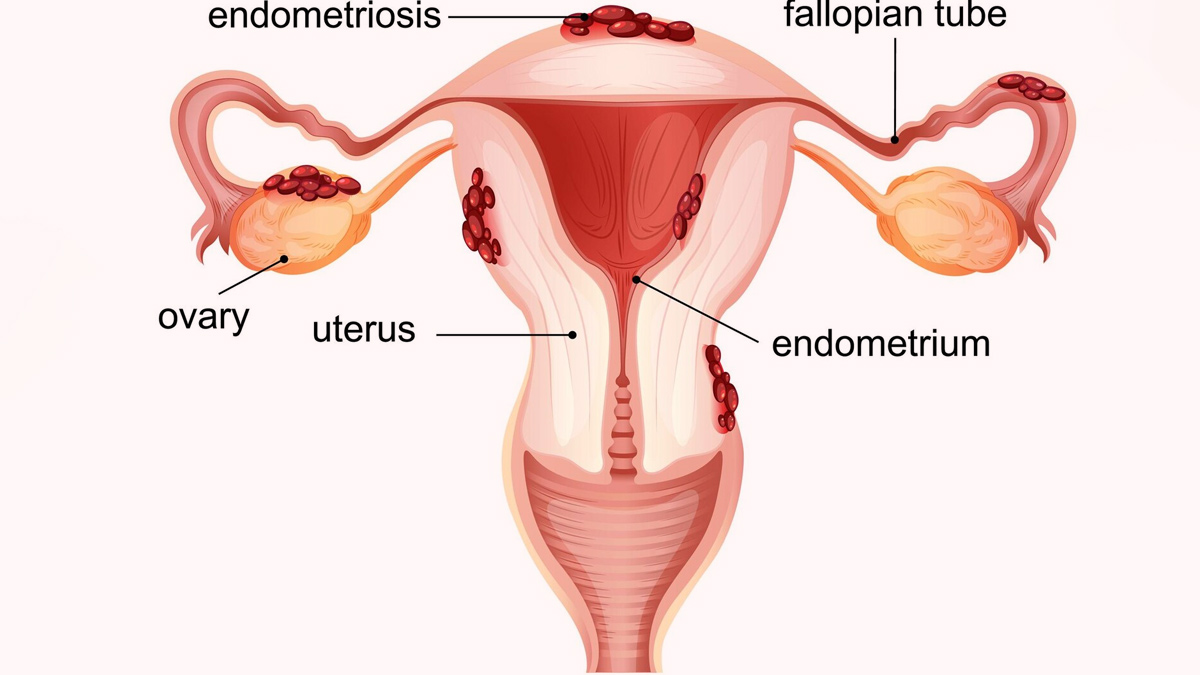 endometrium