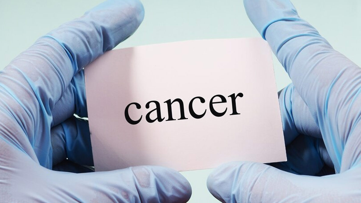 Cancer Isn’t Just a Smoker’s Disease Anymore, Expert Shares the Hidden Risks You Should Know