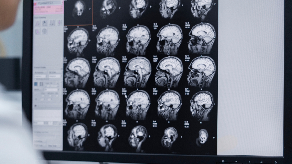 Recent Study Claims Your Brain Has 5 Different Eras In A Lifetime, Know Which You Are In?