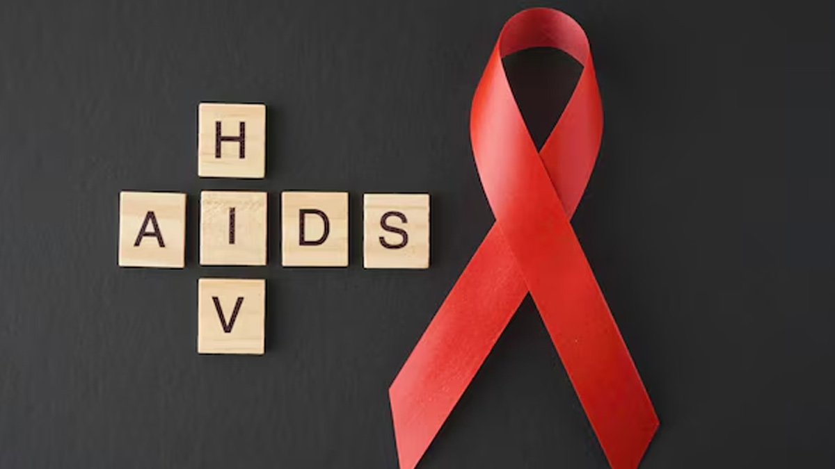 HIV AIDS