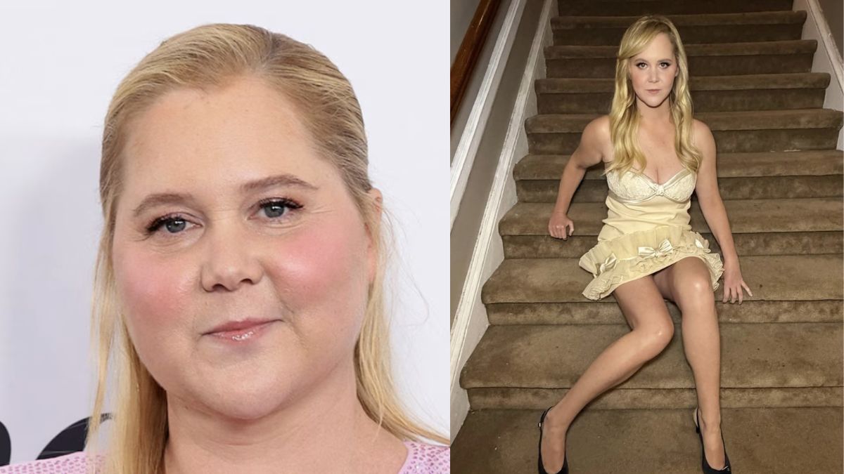 Amy Schumer “Lost 50 Pounds to Survive, Not to Look Hot” and Beat a Killer Disease, Cushing Syndrome