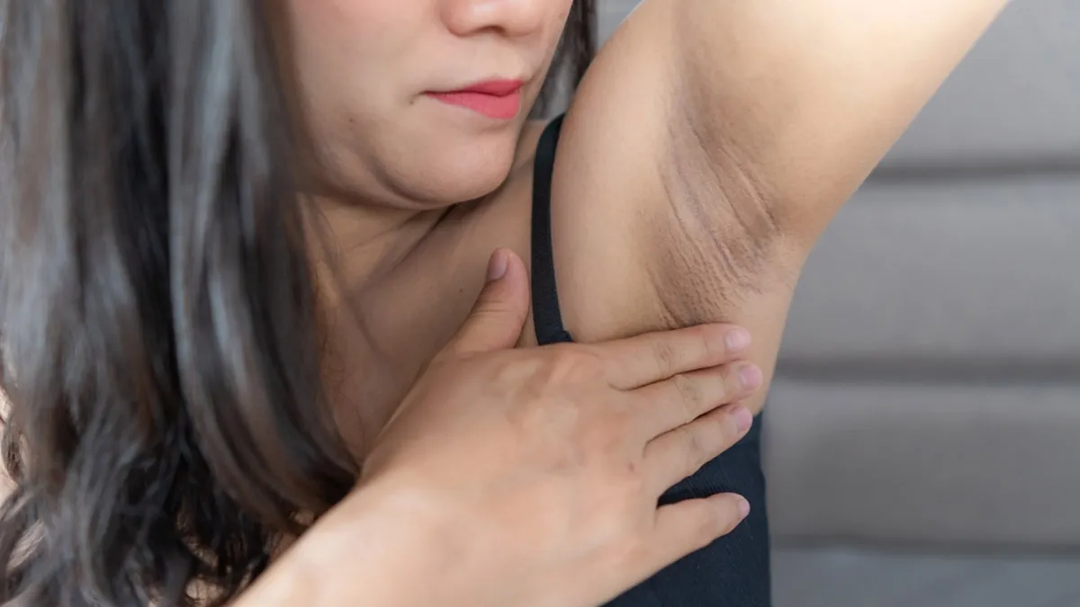 Does Using Deodorant Cause Dark Underarms? Dermat Reveals Truth