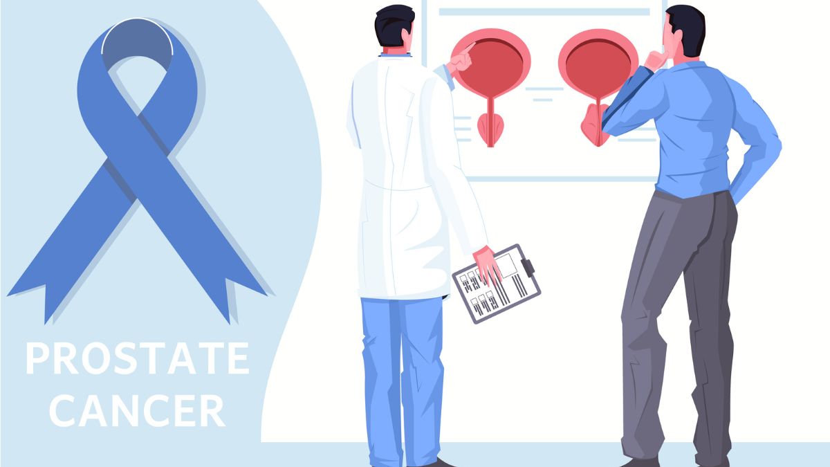 Six Things Your Urologist Wants You To Know About Prostate Cancer Treatment
