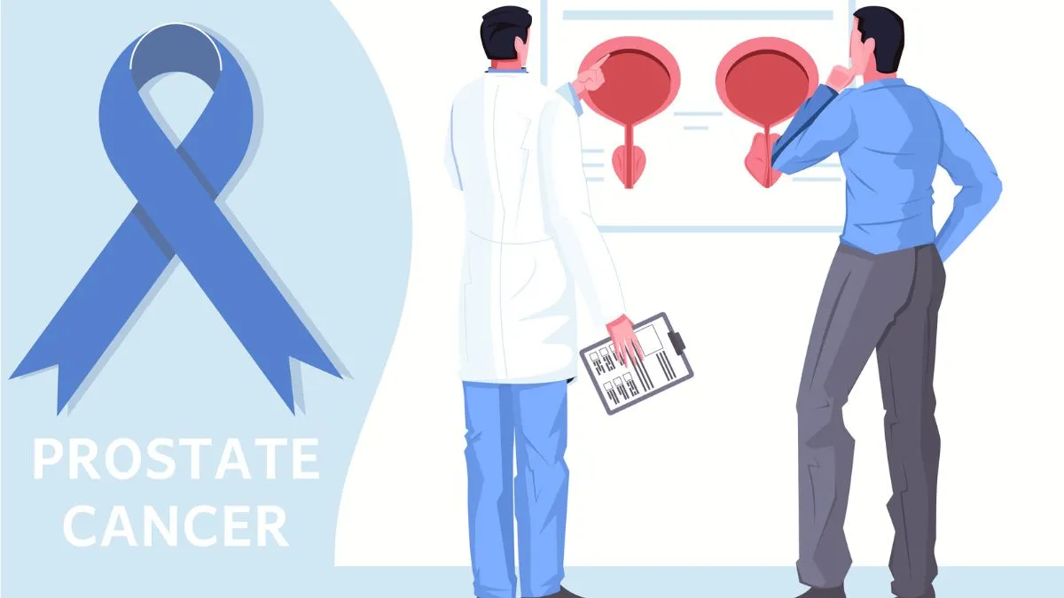 Six Things Your Urologist Wants You To Know About Prostate Cancer Treatment