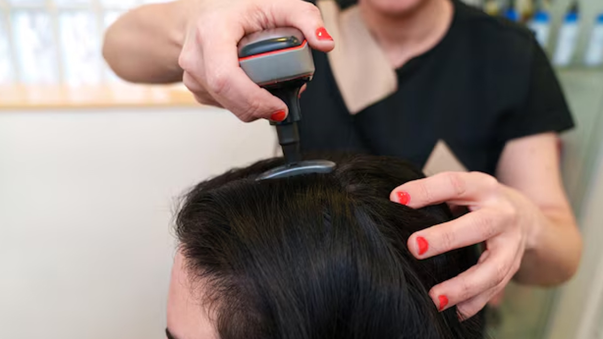 Scalp Microneedling: The New Go-To Treatment for Postpartum Hair Thinning