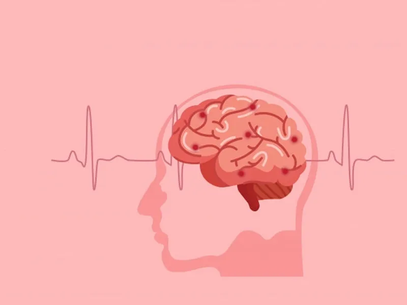 Silent Winter Strokes: Why Brain Attacks Are Often Missed in Cold Weather