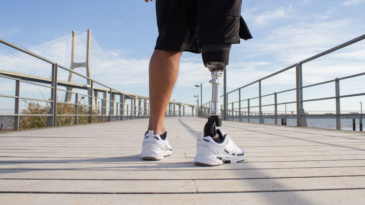 Advancing Prosthetic Care: Expert Insights on Accessibility, Innovation and Quality of Life