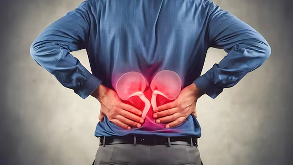Chronic Kidney Disease Explained: Understanding the 5 Stages and Their  Impact on Your Health | OnlyMyHealth