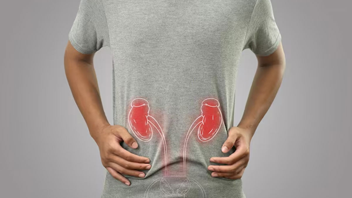 Kidney Stone Size And Treatment: A Complete Medical Guide