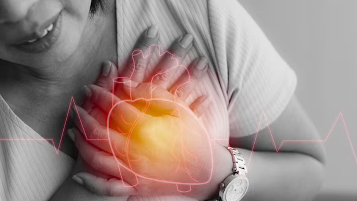 migraine heart 2