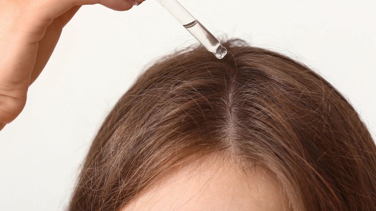 Can Minoxidil Be Used for Postpartum Hair Loss? Dermatologist Shares Timeline and Alternative