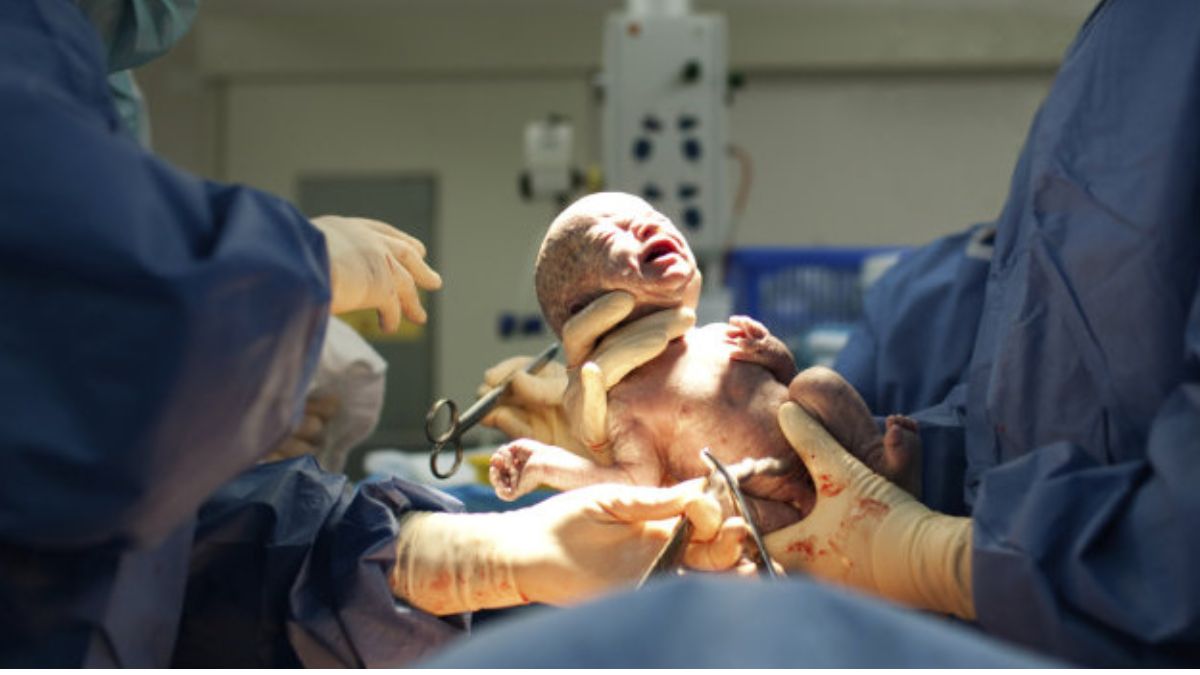 What Is A Premature Baby Birth? A Neonatologist Explains the Risks and Care