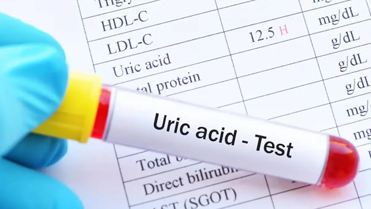 uric acid meat 1