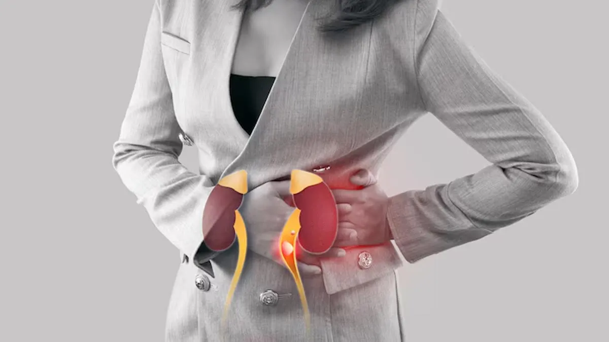kidney stone vs UTI 1