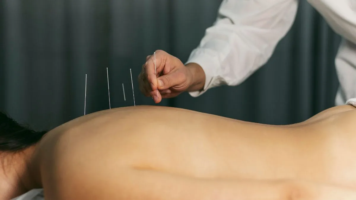 The History of Acupuncture: How This Ancient Practice Evolved Alongside Modern Science