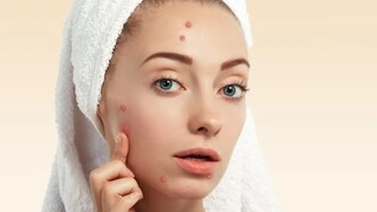 fungal vs regular acne 3