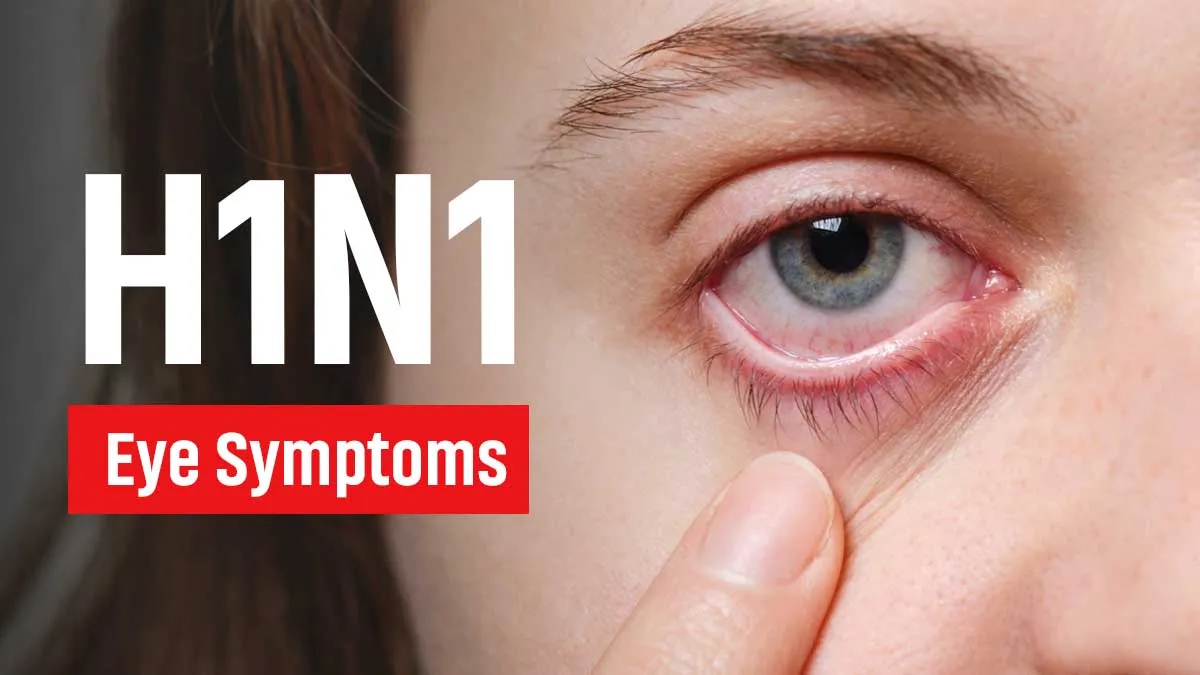 Can H1N1 Affect Your Eyes? Doctors Explain a Lesser-Known Symptom