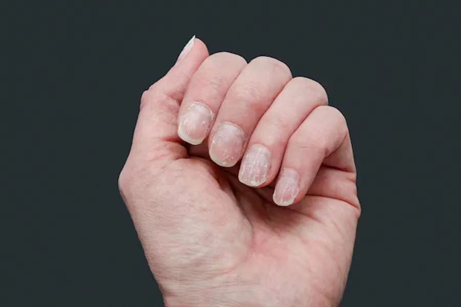 protein skin nails 1